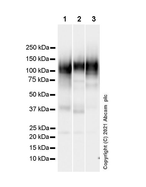 Western blot - Anti-CD68 antibody [EPR20545] - Mouse IgG1 (Chimeric) (AB283316), expandable thumbnail