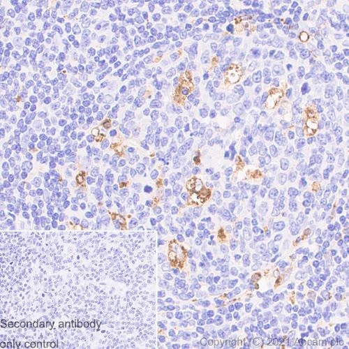 Immunohistochemistry (Formalin/PFA-fixed paraffin-embedded sections) - Anti-CD68 antibody [EPR20545] - Mouse IgG1 (Chimeric) - BSA and Azide free (AB283338)