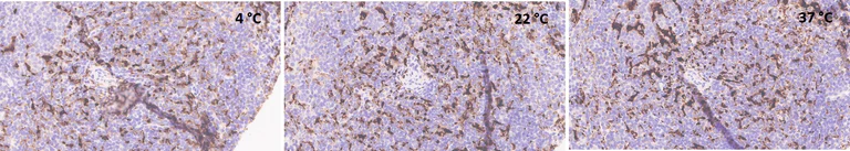 Immunohistochemistry (Formalin/PFA-fixed paraffin-embedded sections) - Anti-CD68 antibody [EPR23917-164] (AB283654)