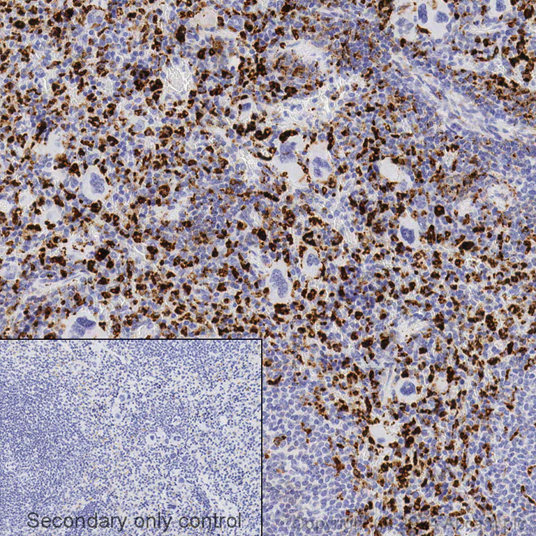 Immunohistochemistry - Anti-CD68 antibody [EPR23917-164] (AB283654)