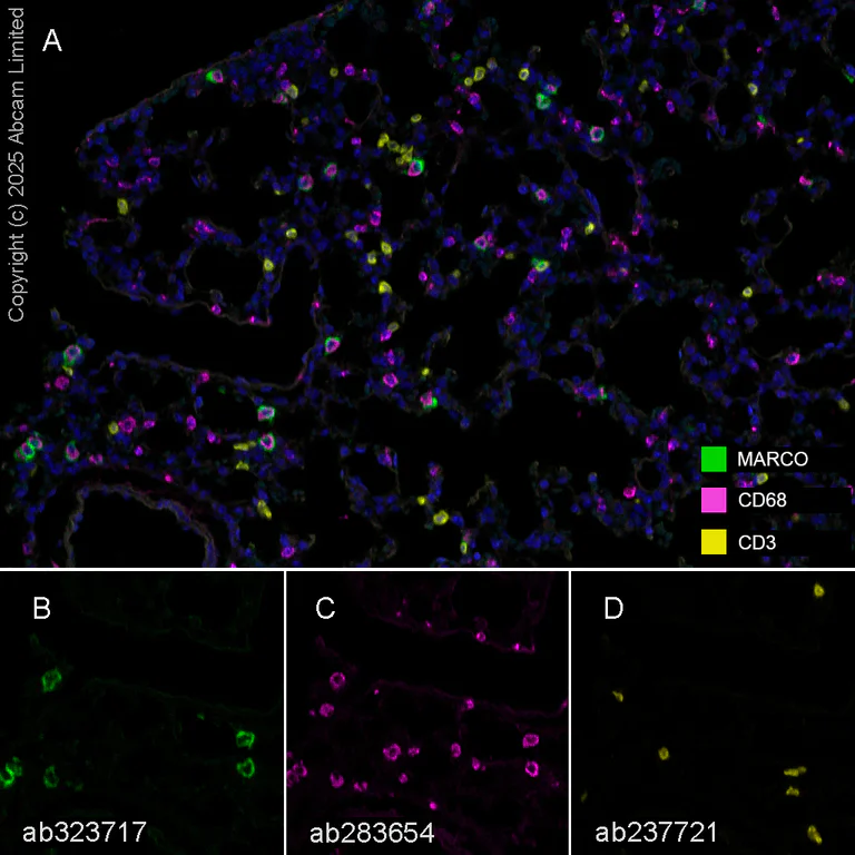 Multiplex immunohistochemistry - Anti-CD68 antibody [EPR23917-164] (AB283654)