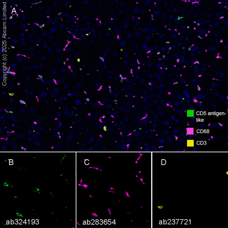 Multiplex immunohistochemistry - Anti-CD68 antibody [EPR23917-164] (AB283654)