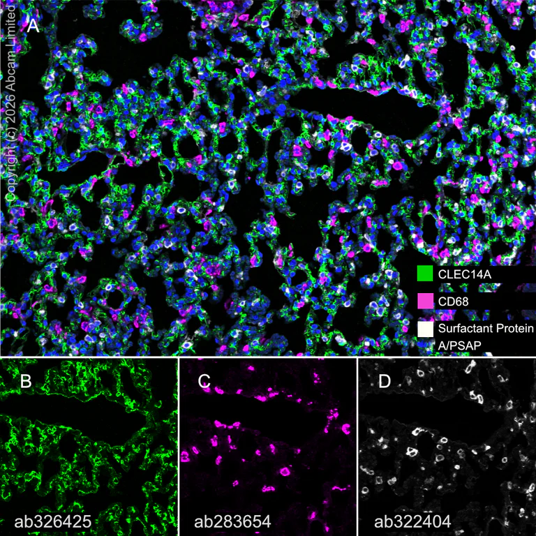 Multiplex immunohistochemistry - Anti-CD68 antibody [EPR23917-164] (AB283654)