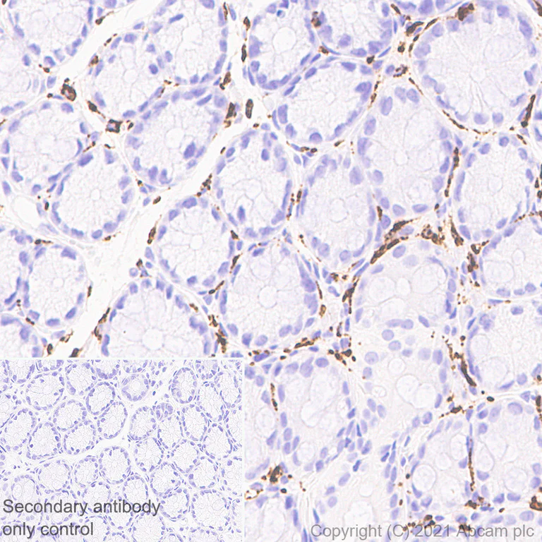 Immunohistochemistry (Formalin/PFA-fixed paraffin-embedded sections) - Anti-CD68 antibody [EPR23917-164] - BSA and Azide free (AB283667)
