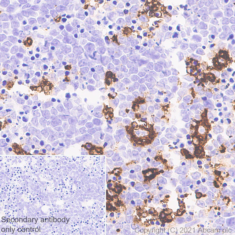 Immunohistochemistry (Formalin/PFA-fixed paraffin-embedded sections) - Anti-CD68 antibody [EPR23917-164] - BSA and Azide free (AB283667)