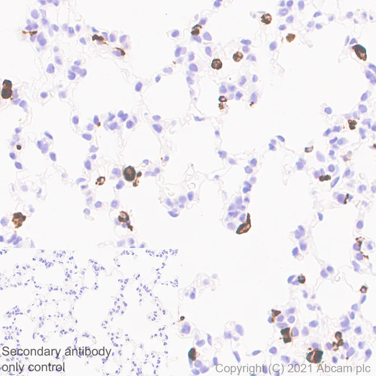 Immunohistochemistry (Formalin/PFA-fixed paraffin-embedded sections) - Anti-CD68 antibody [EPR23917-164] - BSA and Azide free (AB283667)