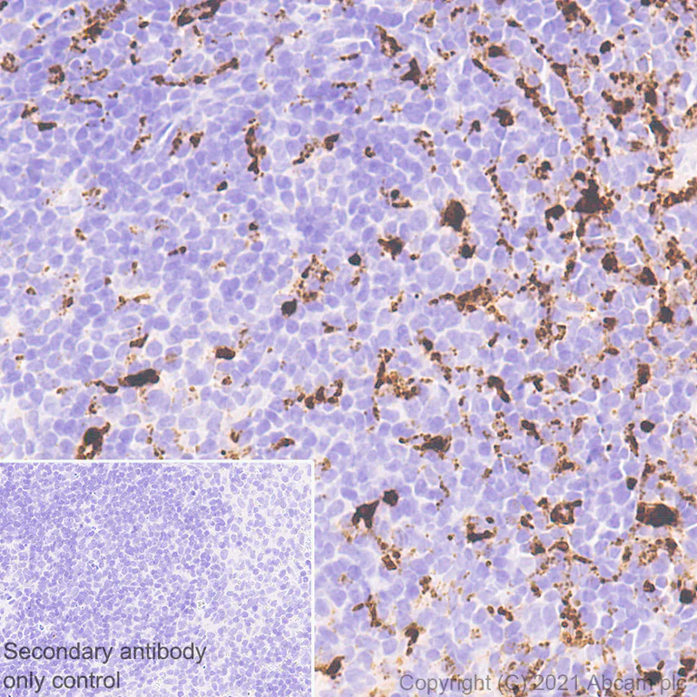Immunohistochemistry (Formalin/PFA-fixed paraffin-embedded sections) - Anti-CD68 antibody [EPR23917-164] - BSA and Azide free (AB283667)