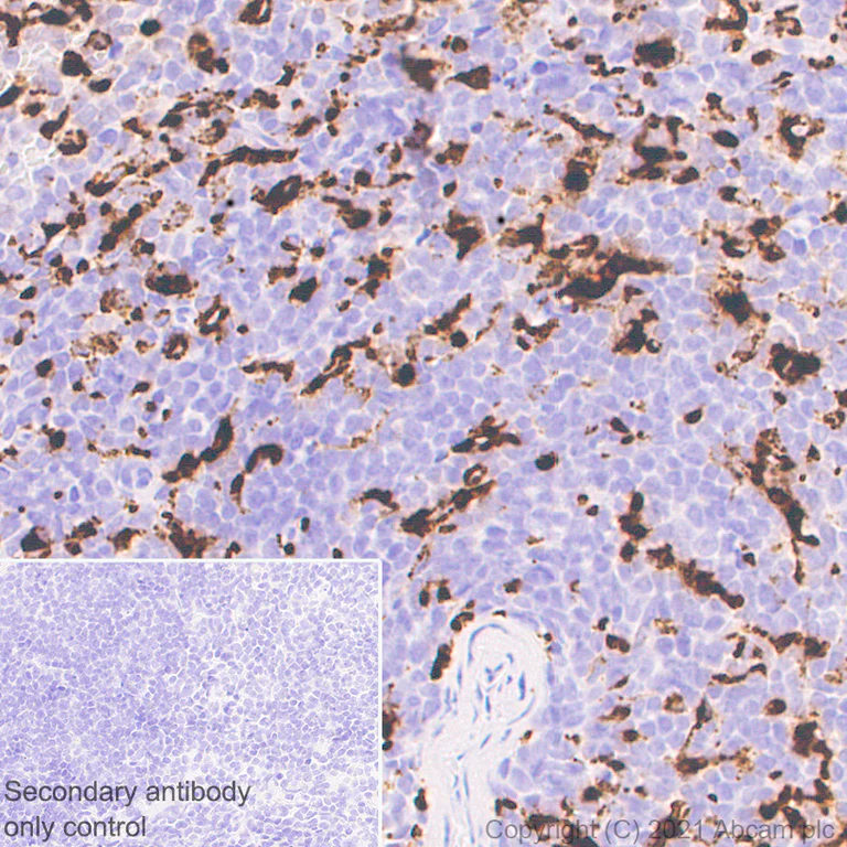 Immunohistochemistry (Formalin/PFA-fixed paraffin-embedded sections) - Anti-CD68 antibody [EPR23917-164] - BSA and Azide free (AB283667)
