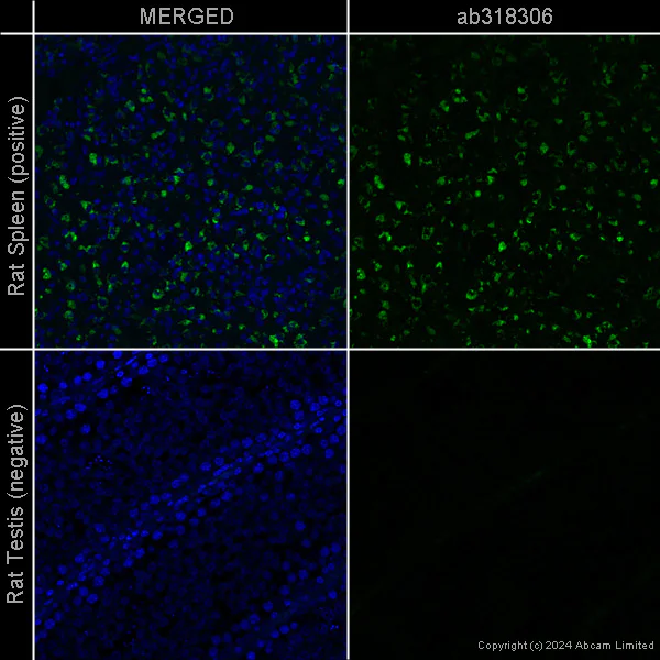 Immunohistochemistry (Formalin/PFA-fixed paraffin-embedded sections) - Anti-CD68 antibody [EPR23917-164] – Chicken IgY (Chimeric) – BSA and Azide Free (AB318306)