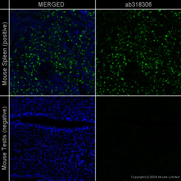 Immunohistochemistry (Formalin/PFA-fixed paraffin-embedded sections) - Anti-CD68 antibody [EPR23917-164] – Chicken IgY (Chimeric) – BSA and Azide Free (AB318306)
