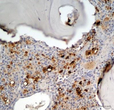 Immunohistochemistry (Formalin/PFA-fixed paraffin-embedded sections) - Anti-CD68 antibody [KP1] (AB955), expandable thumbnail