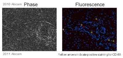 Immunohistochemistry (Formalin/PFA-fixed paraffin-embedded sections) - Anti-CD68 antibody [KP1] (AB955), expandable thumbnail