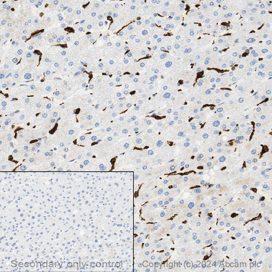 Immunohistochemistry (Formalin/PFA-fixed paraffin-embedded sections) - Anti-CD68 antibody [KP1] (ab955), expandable thumbnail