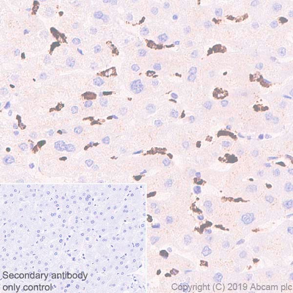 Immunohistochemistry (Formalin/PFA-fixed paraffin-embedded sections) - Anti-CD68 antibody [KP1] (AB955), expandable thumbnail