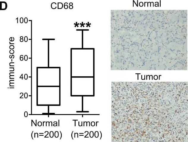 Immunohistochemistry - Anti-CD68 antibody [KP1] (AB955)
