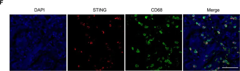 Immunohistochemistry - Anti-CD68 antibody [KP1] (AB955)