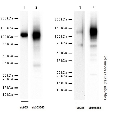 Western blot - Anti-CD68 antibody [KP1] (ab955), expandable thumbnail