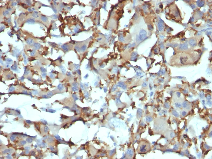 Immunohistochemistry (Formalin/PFA-fixed paraffin-embedded sections) - Anti-CD68 antibody [KP1 + C68/684] (AB199000)