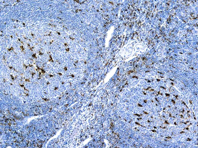 Immunohistochemistry (Formalin/PFA-fixed paraffin-embedded sections) - Anti-CD68 antibody [KP1], prediluted (AB845)