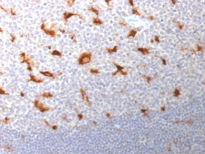Immunohistochemistry (Formalin/PFA-fixed paraffin-embedded sections) - Anti-CD68 antibody [LAMP4/1830] (AB238094), expandable thumbnail