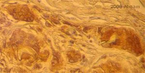 Immunohistochemistry (Formalin/PFA-fixed paraffin-embedded sections) - Anti-CD68 antibody [PG-M1] (AB783)