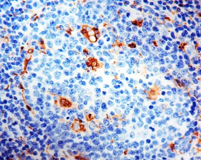 Immunohistochemistry (Formalin/PFA-fixed paraffin-embedded sections) - Anti-CD68 antibody [PG-M1], prediluted (AB844)