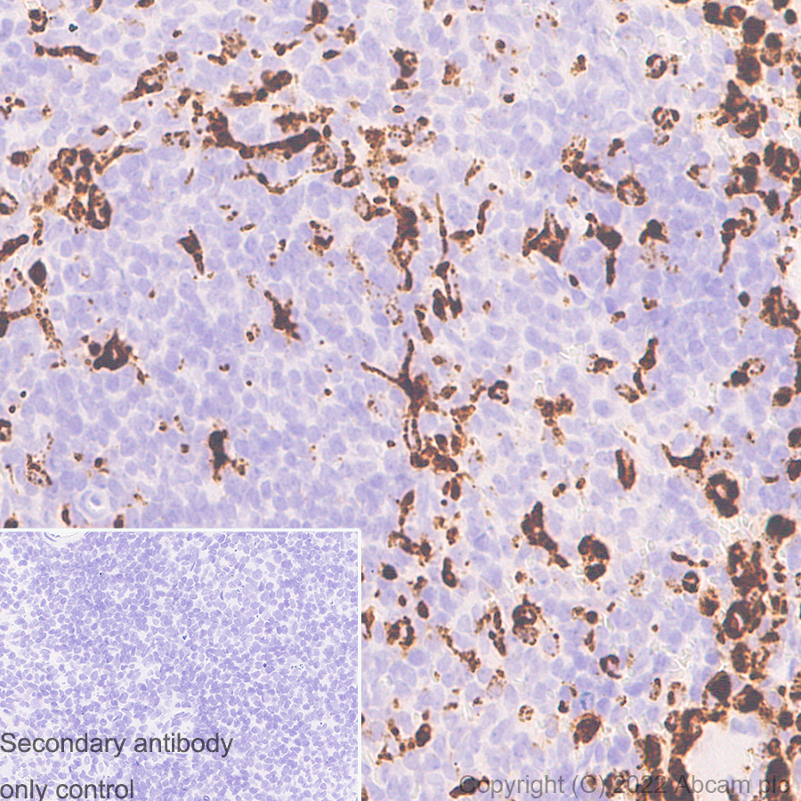 Immunohistochemistry - Anti-CD68 antibody [RM1031] - BSA and Azide free (AB303566), expandable thumbnail