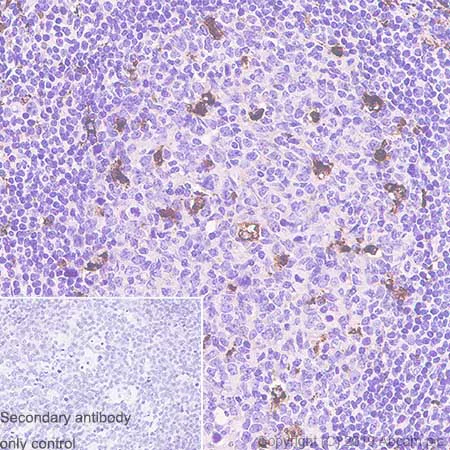 Immunohistochemistry (Formalin/PFA-fixed paraffin-embedded sections) - Anti-CD68 antibody [SP251] (AB192847)