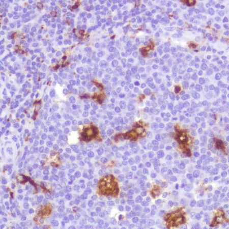 Immunohistochemistry (Formalin/PFA-fixed paraffin-embedded sections) - Anti-CD68 antibody [SP251] (AB192847)