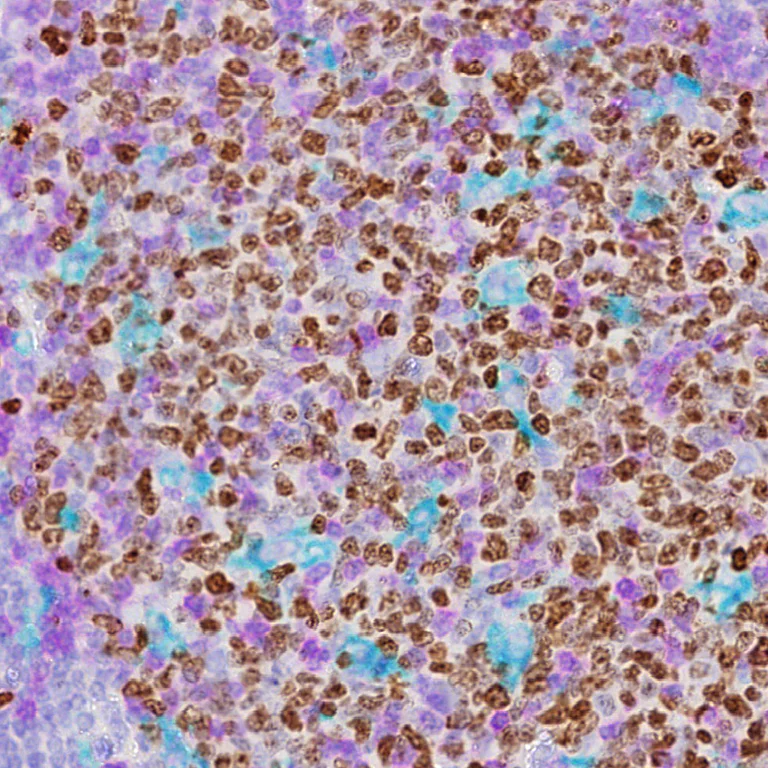 Multiplex immunohistochemistry - Anti-CD68 antibody [SP251] (AB192847)