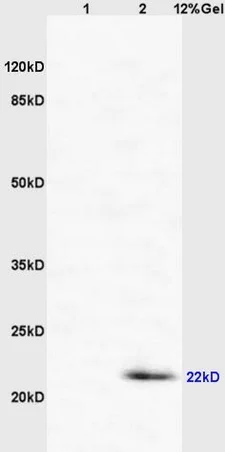 Western blot - Anti-CD69 antibody (AB202909)