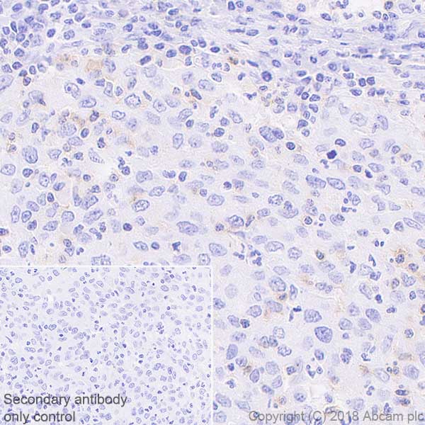 Immunohistochemistry (Formalin/PFA-fixed paraffin-embedded sections) - Anti-CD69 antibody [EPR21811] (AB233395)