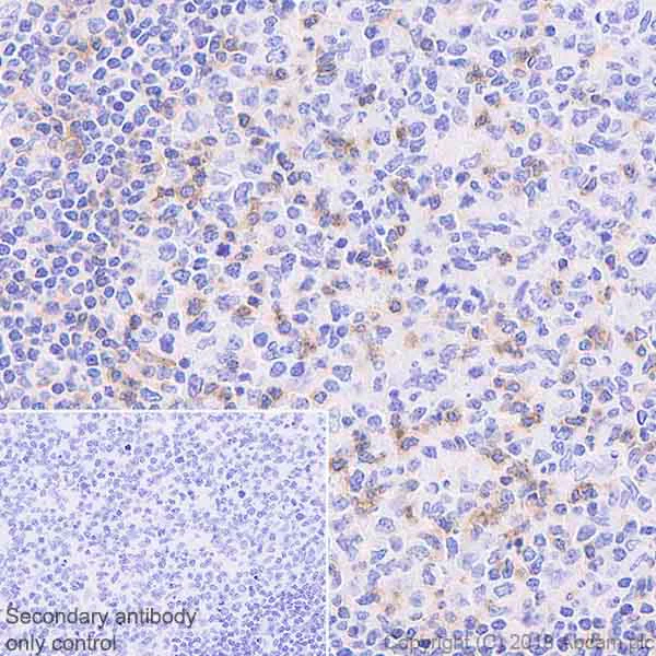 Immunohistochemistry (Formalin/PFA-fixed paraffin-embedded sections) - Anti-CD69 antibody [EPR21811] (AB233395)