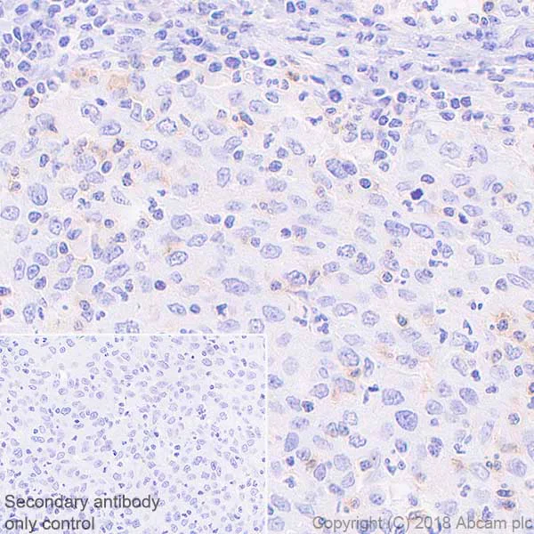 Immunohistochemistry (Formalin/PFA-fixed paraffin-embedded sections) - Anti-CD69 antibody [EPR21811] - BSA and Azide free (AB234511)
