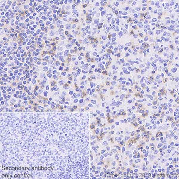 Immunohistochemistry (Formalin/PFA-fixed paraffin-embedded sections) - Anti-CD69 antibody [EPR21811] - BSA and Azide free (AB234511)