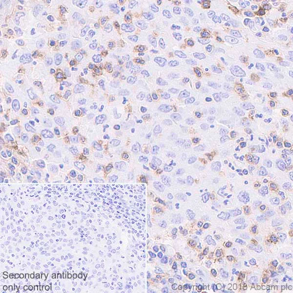 Immunohistochemistry (Formalin/PFA-fixed paraffin-embedded sections) - Anti-CD69 antibody [EPR21814] (AB233396)