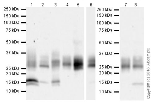 Western blot - Anti-CD69 antibody [EPR21814] (AB233396)