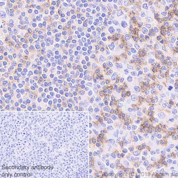 Immunohistochemistry (Formalin/PFA-fixed paraffin-embedded sections) - Anti-CD69 antibody [EPR21814] - BSA and Azide free (AB234512)