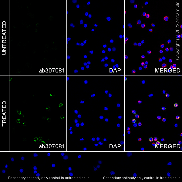 Immunocytochemistry/ Immunofluorescence - Anti-CD69 antibody [EPR25398-81] (ab307081), expandable thumbnail
