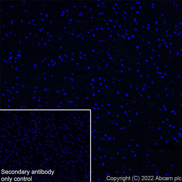 Immunohistochemistry (Frozen sections) - Anti-CD69 antibody [EPR25398-81] (ab307081), expandable thumbnail