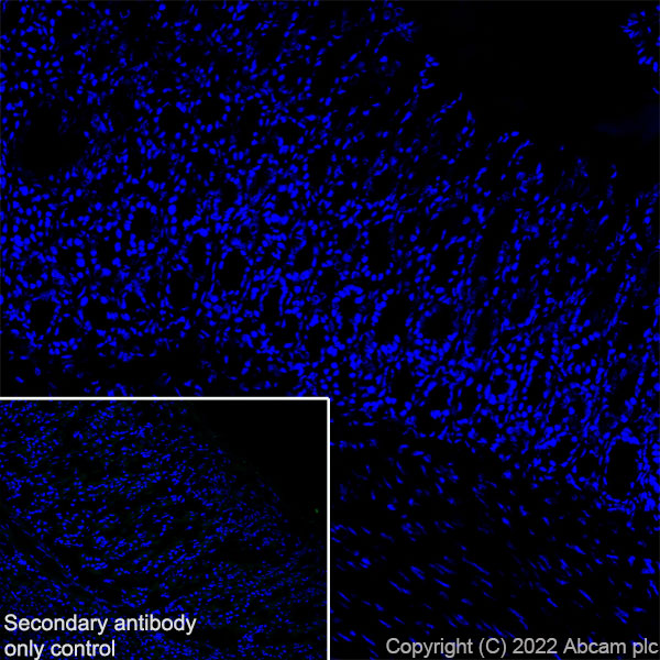 Immunohistochemistry (Frozen sections) - Anti-CD69 antibody [EPR25398-81] (ab307081), expandable thumbnail