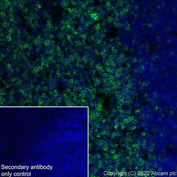 Immunohistochemistry (Frozen sections) - Anti-CD69 antibody [EPR25398-81] (AB307081)