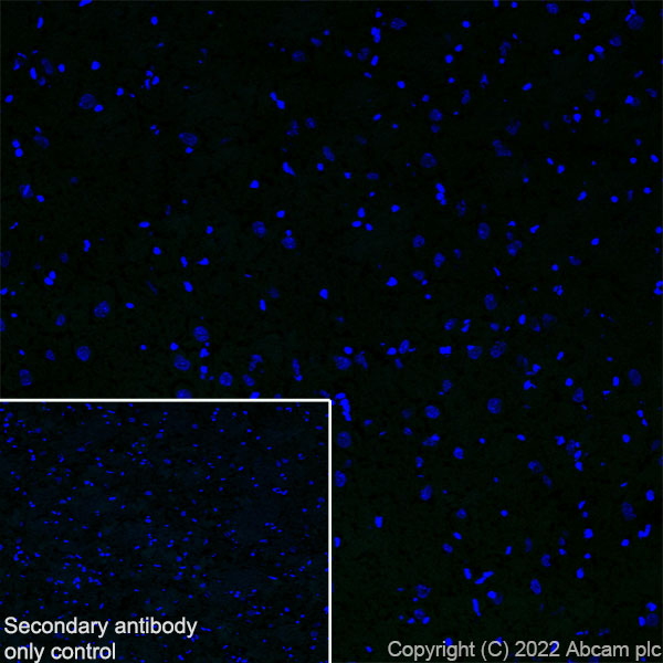 Immunohistochemistry (Frozen sections) - Anti-CD69 antibody [EPR25398-81] (ab307081), expandable thumbnail