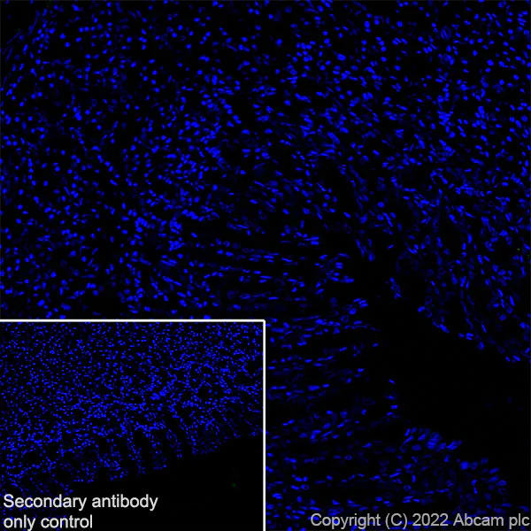 Immunohistochemistry (Frozen sections) - Anti-CD69 antibody [EPR25398-81] (AB307081)