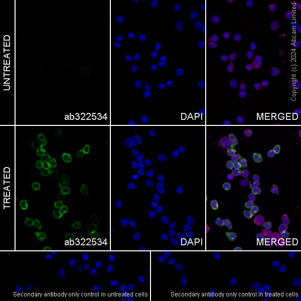 Anti-CD69 antibody [RM1274] (ab322534) | Abcam
