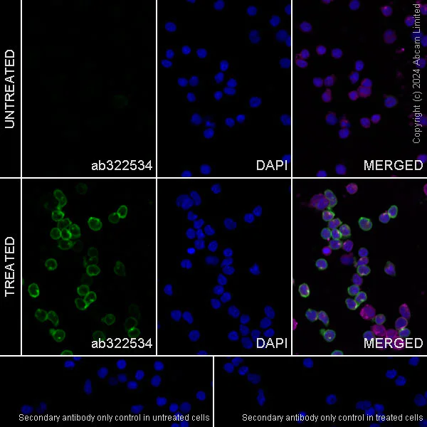 Anti-CD69 antibody [RM1274] (ab322534) | Abcam