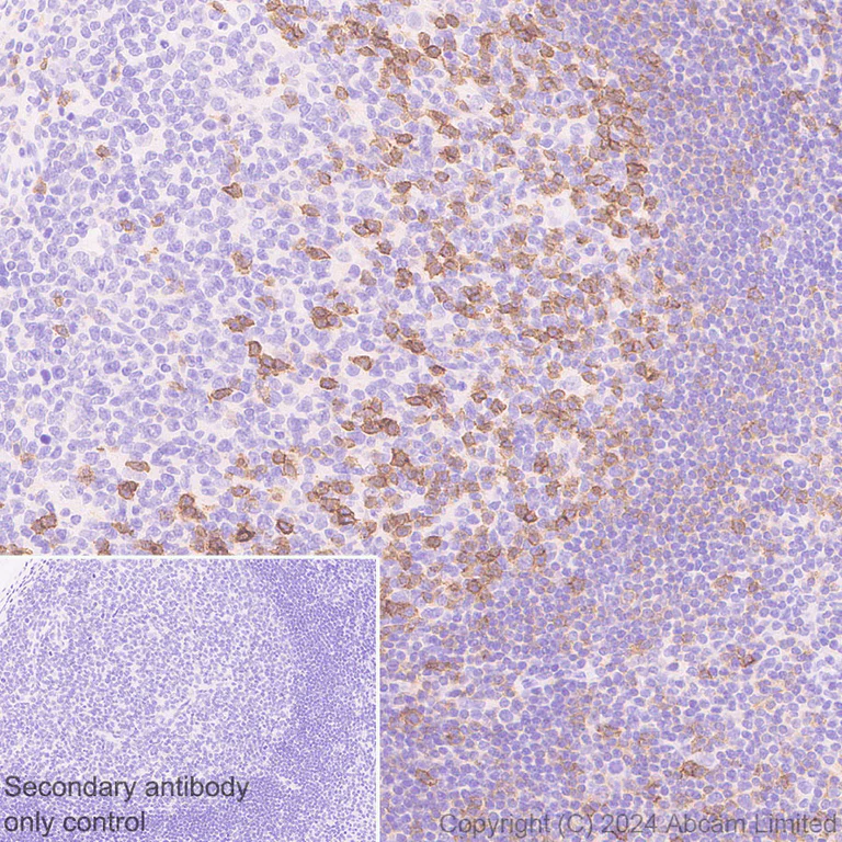 Immunohistochemistry (Formalin/PFA-fixed paraffin-embedded sections) - Anti-CD69 antibody [RM1274] (AB322534)