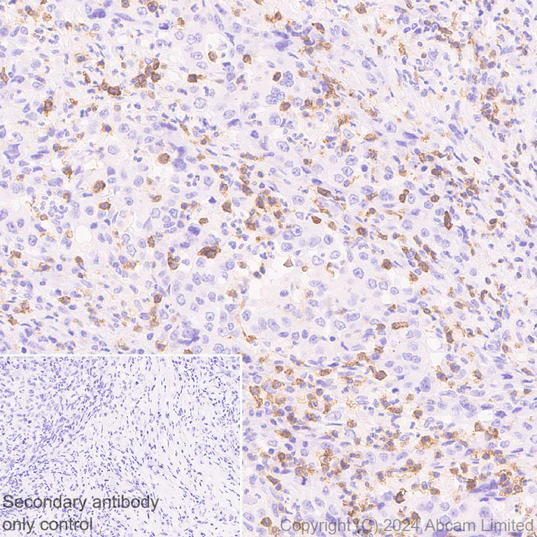 Anti-CD69 antibody [RM1274] (ab322534) | Abcam