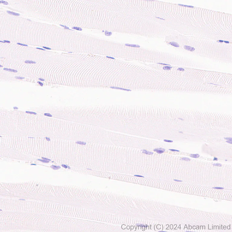 Immunohistochemistry (Formalin/PFA-fixed paraffin-embedded sections) - Anti-CD69 antibody [RM1274] (AB322534)