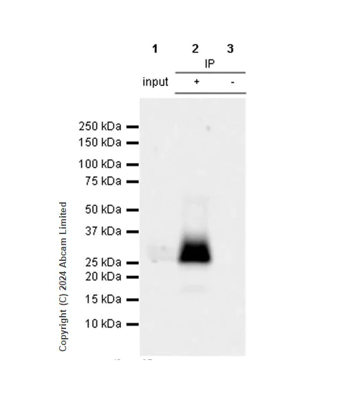 Immunoprecipitation - Anti-CD69 antibody [RM1274] (AB322534)
